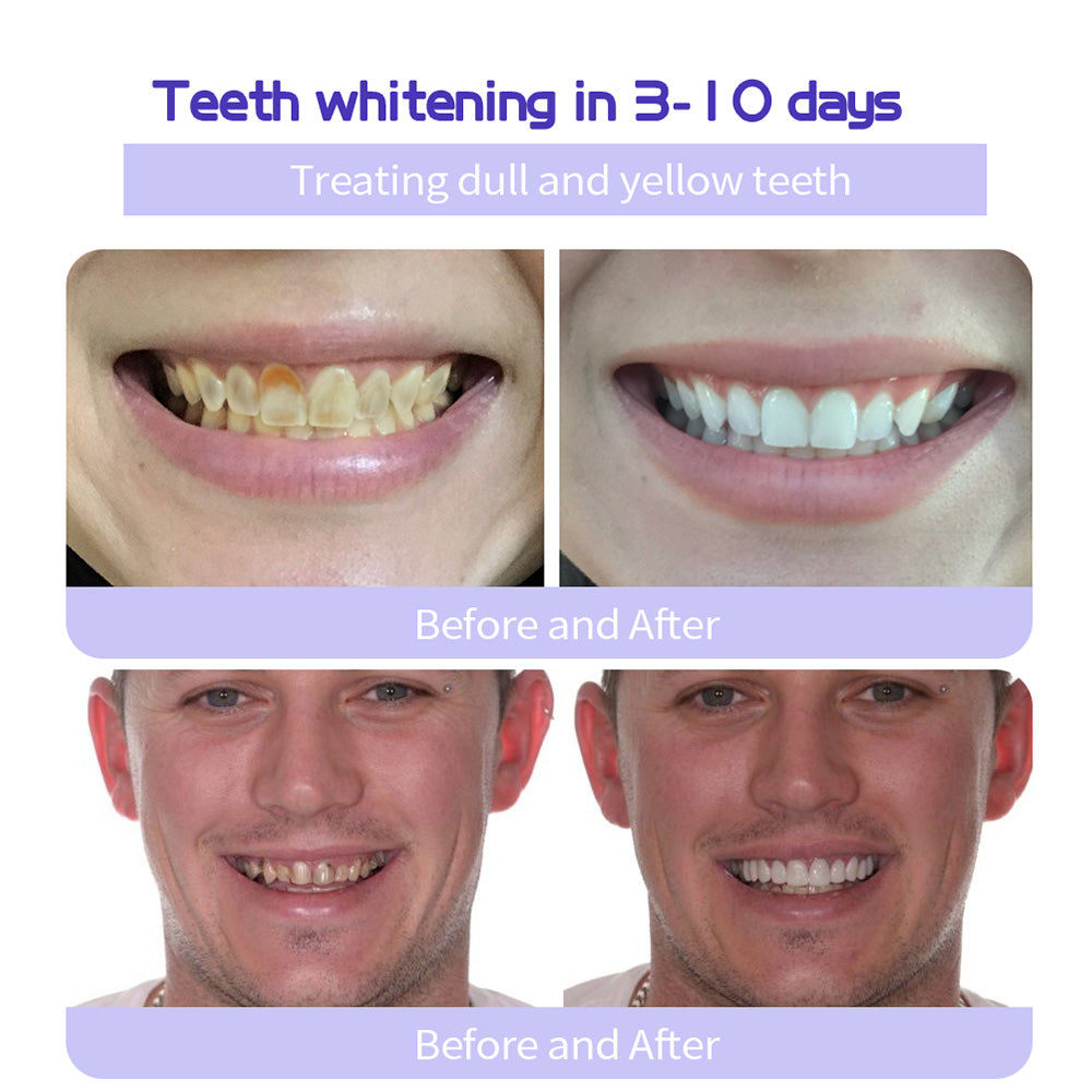 AQA™ Fluoride-Free Nano-Hydroxyapatite Toothpaste🦷(ADA recommended)(🎁Flash Sale - Don’t Miss Out)