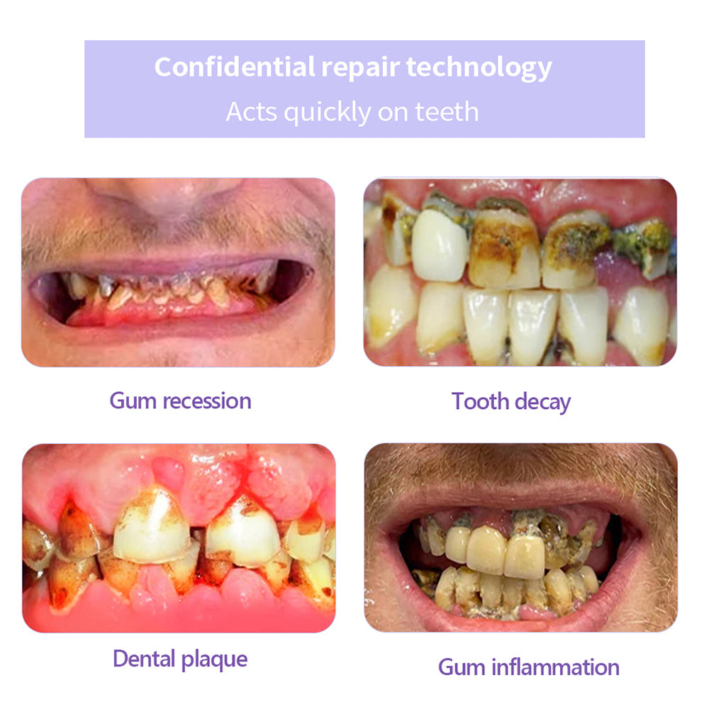 AQA™ Fluoride-Free Nano-Hydroxyapatite Toothpaste🦷(ADA recommended)(🎁Flash Sale - Don’t Miss Out)