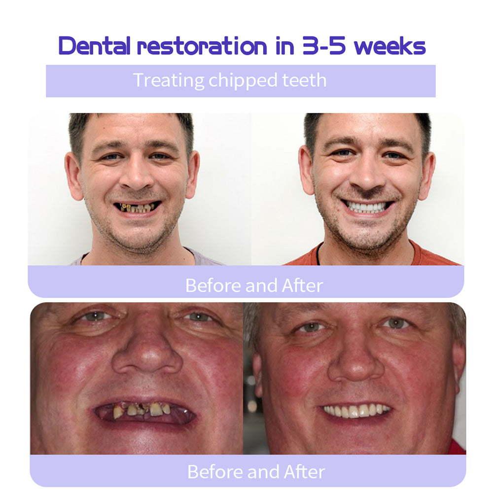 AQA™ Fluoride-Free Nano-Hydroxyapatite Toothpaste🦷(ADA recommended)(🎁Flash Sale - Don’t Miss Out)