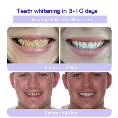 AQA™ Fluoride-Free Nano-Hydroxyapatite Toothpaste🦷(ADA recommended)(🎁Flash Sale - Don’t Miss Out)