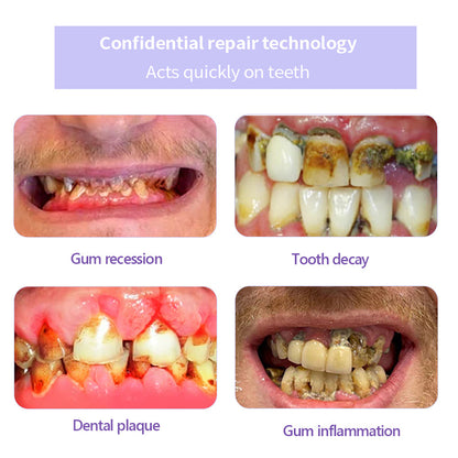 AQA™ Fluoride-Free Nano-Hydroxyapatite Toothpaste🦷(ADA recommended)(🎁Flash Sale - Don’t Miss Out)